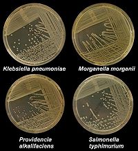 http://upload.wikimedia.org/wikipedia/en/thumb/b/b8/K_pneumoniae_M_morganii_providencia_styphimuriuma.JPG/200px-K_pneumoniae_M_morganii_providencia_styphimuriuma.JPG